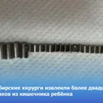 Новосибирские хирурги провели операцию по извлечению более двадцати магнитов из кишечника ребёнка.